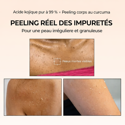 Brume Corps Éclat | Acide Kojique, Curcuma & Niacinamide | FLEXQW